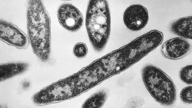 Legionnaires Prevention 